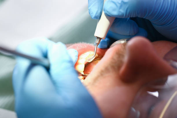 Best Urgent Tooth Repair  in Edmore, MI